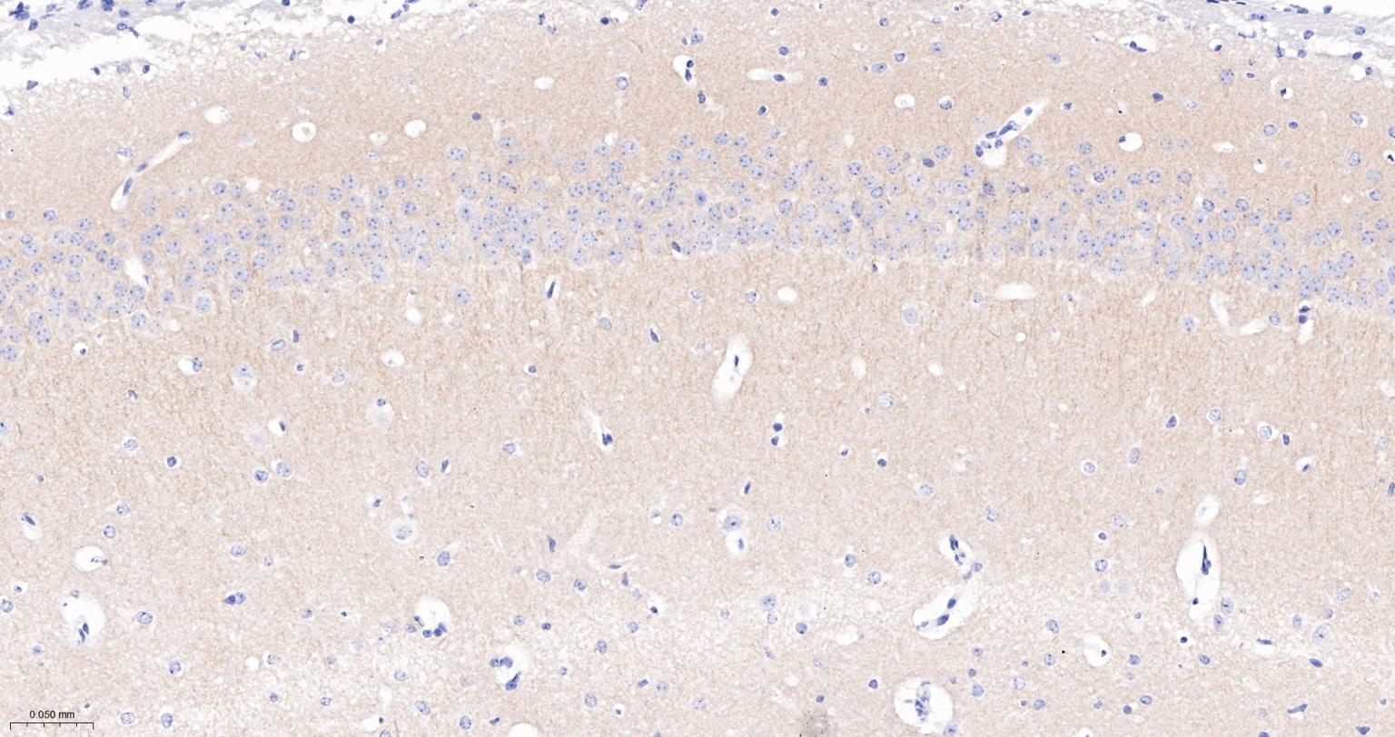 PSD95 Recombinant Rabbit mAb (一抗) - IHC-P,IHC-F,IF | Bioss