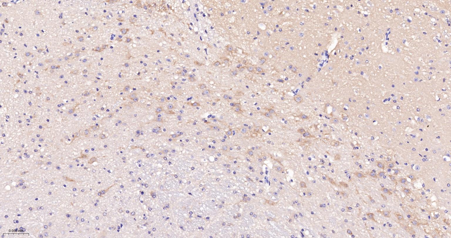 蛋白激酶C α重组兔单抗-bsm-63319R