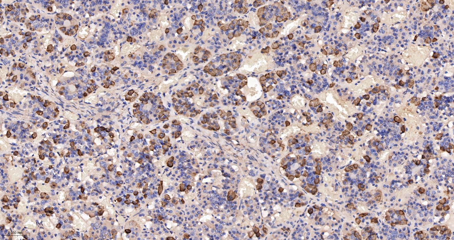 促肾上腺皮质激素重组兔单克隆抗体-bsm-60798R