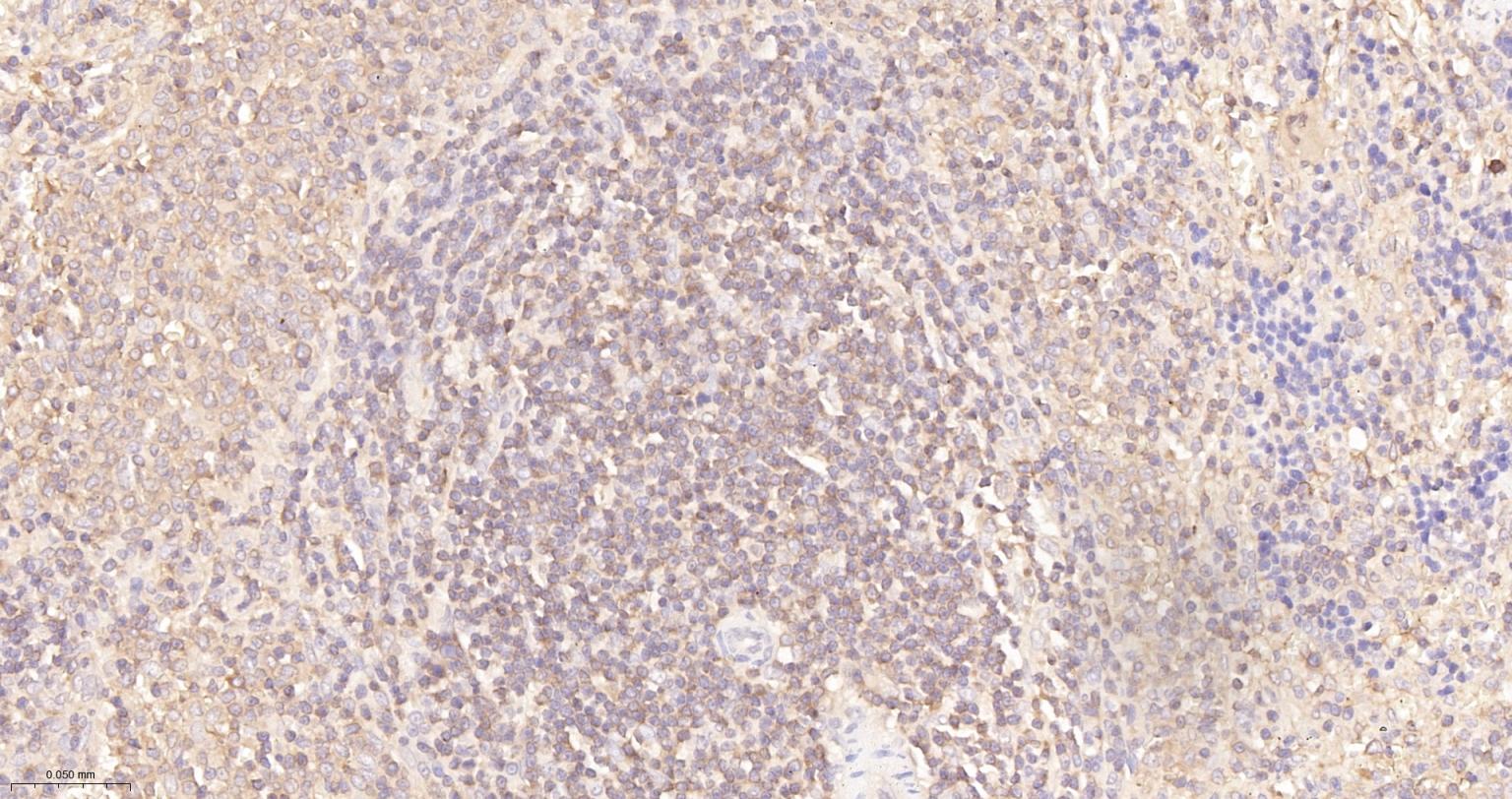 蛋白激酶C α重组兔单抗-bsm-63319R