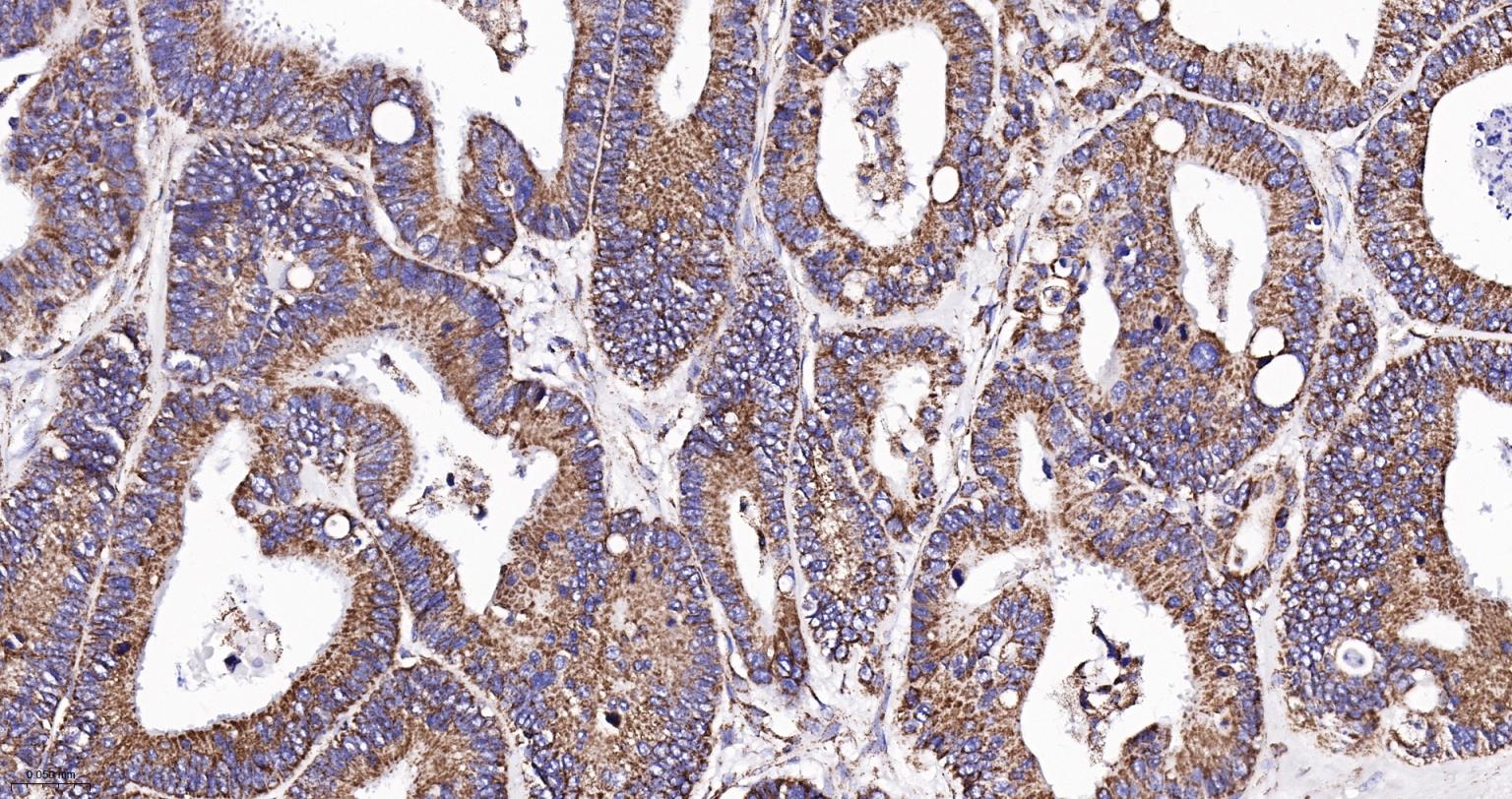 ATP5A重组兔单抗-bsm-61444R