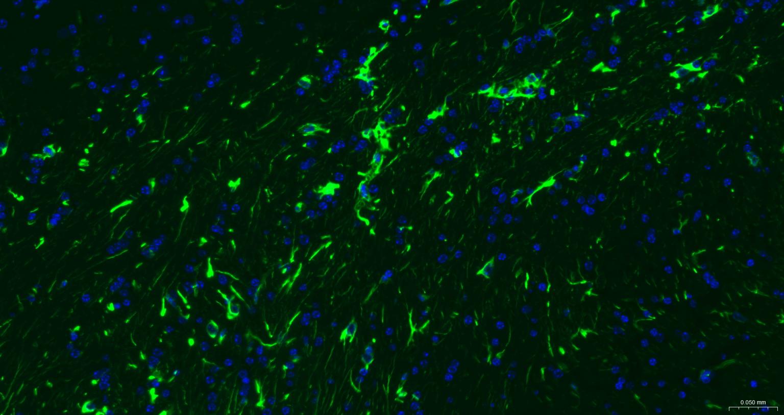 胶质纤维酸性蛋白单克隆抗体-bsm-42001M