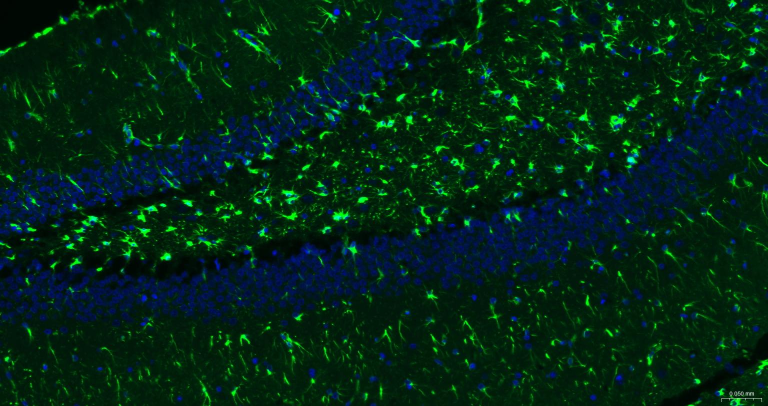 胶质纤维酸性蛋白单克隆抗体-bsm-42001M
