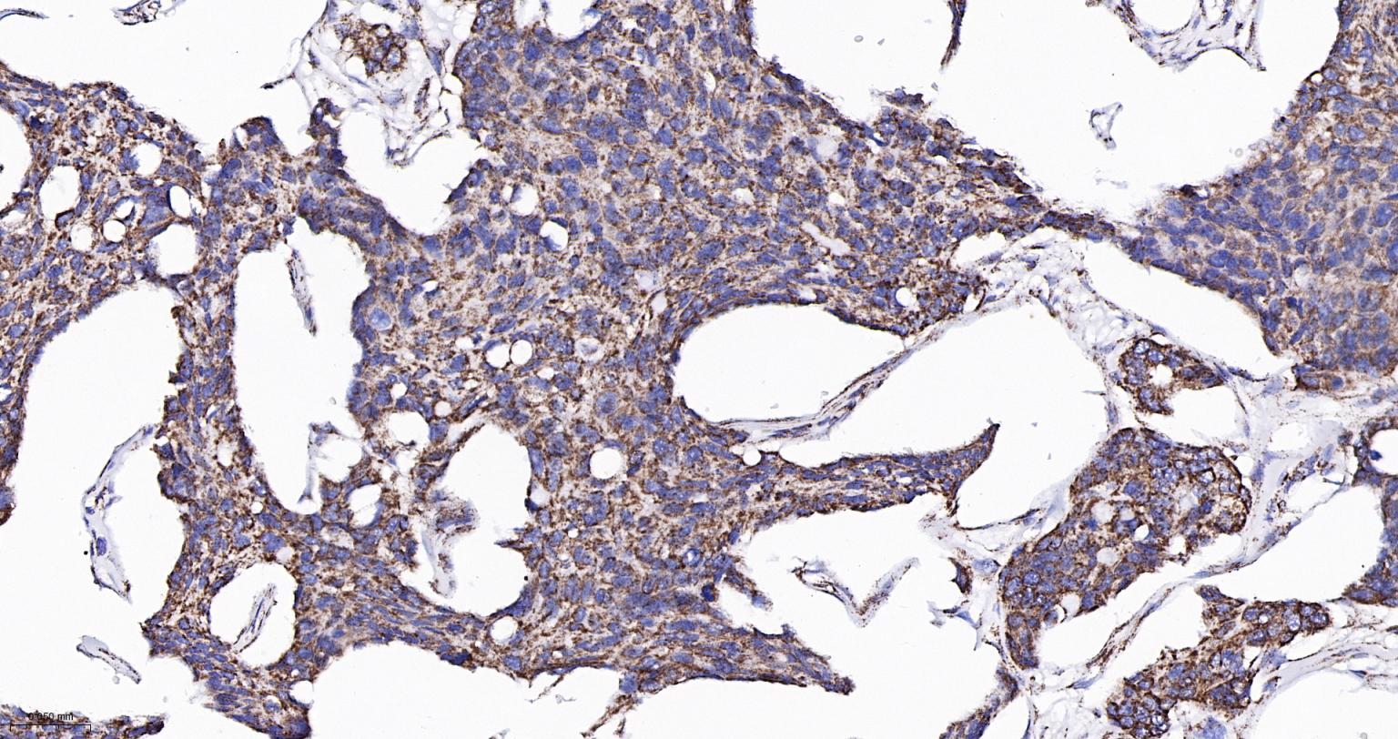 ATP5A重组兔单抗-bsm-61444R