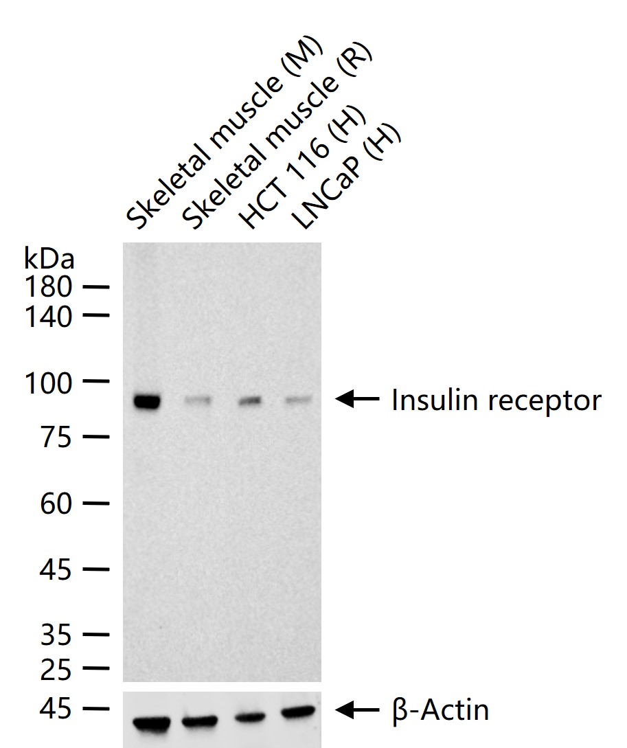 Insulin receptor Recombinant Rabbit mAb (一抗) - WB,ICC/IF | Bioss