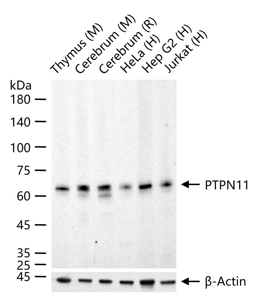 PTPN11 Recombinant Rabbit mAb (一抗) - WB,IP | Bioss