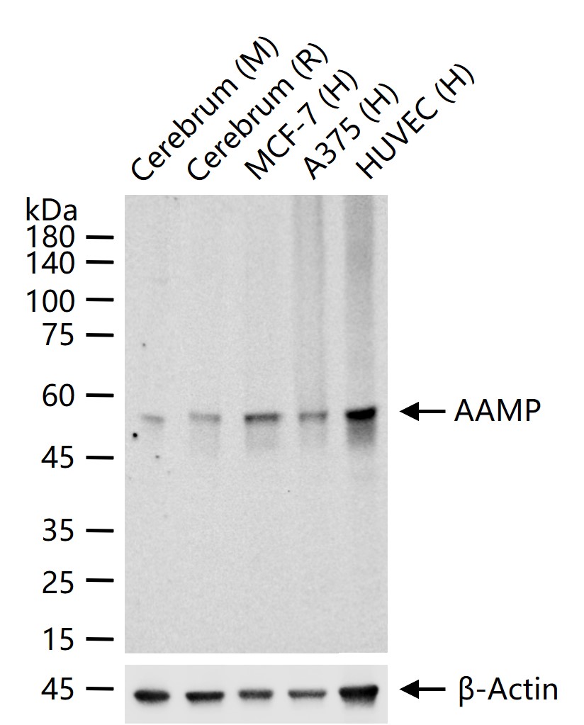 AAMP Recombinant Rabbit mAb (一抗) - WB,Flow-Cyt,ICC/IF | Bioss