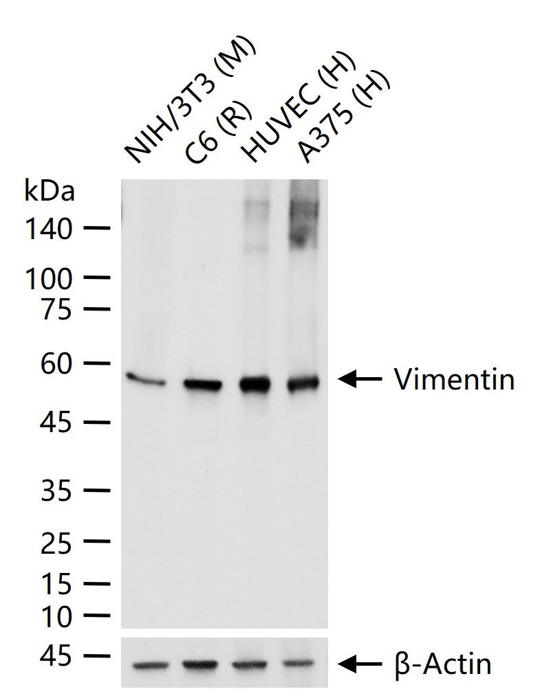 波形蛋白重组兔单抗-bsm-63101R