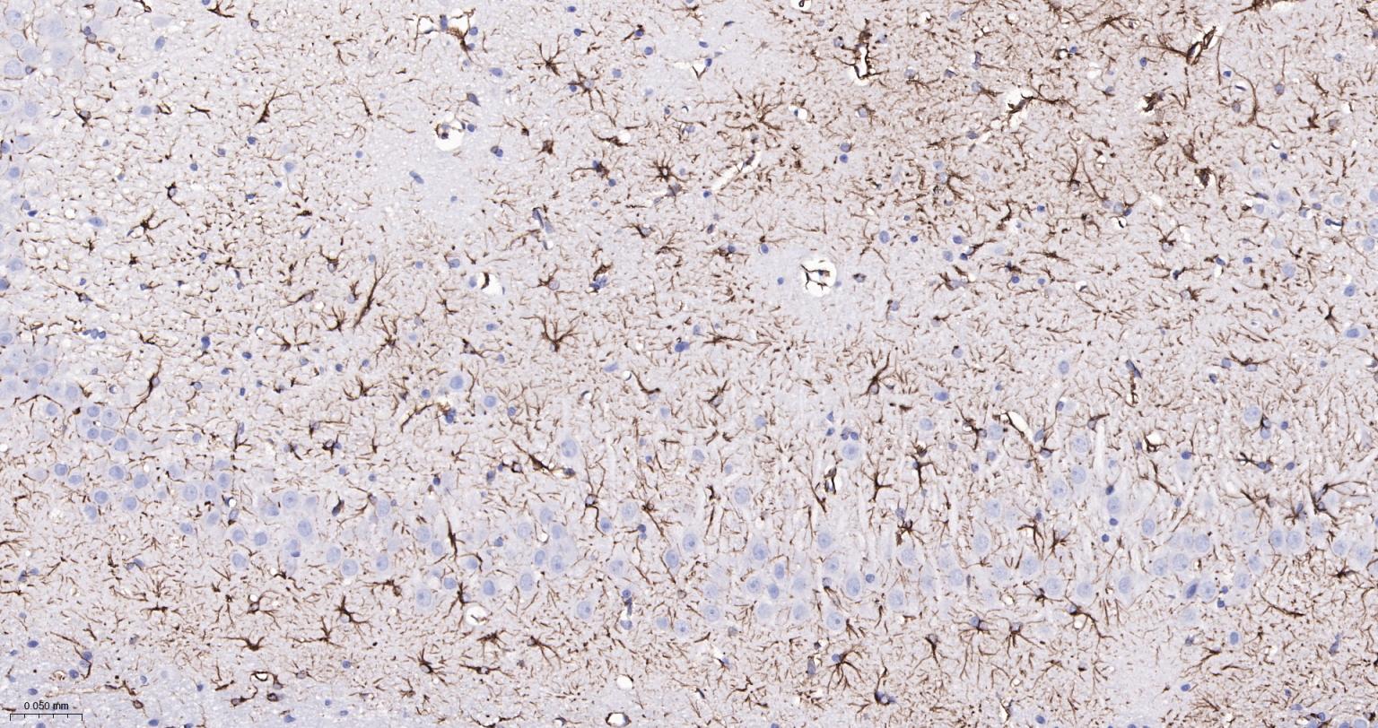 胶质纤维酸性蛋白单克隆抗体-bsm-42001M