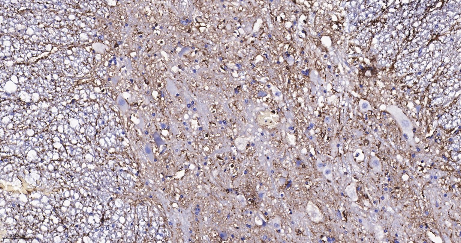 胶质纤维酸性蛋白单克隆抗体-bsm-42001M