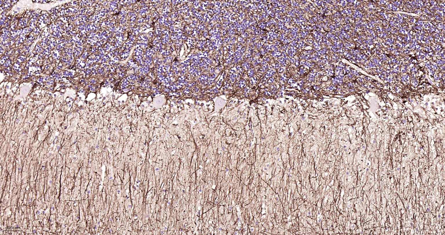 胶质纤维酸性蛋白单克隆抗体-bsm-42001M