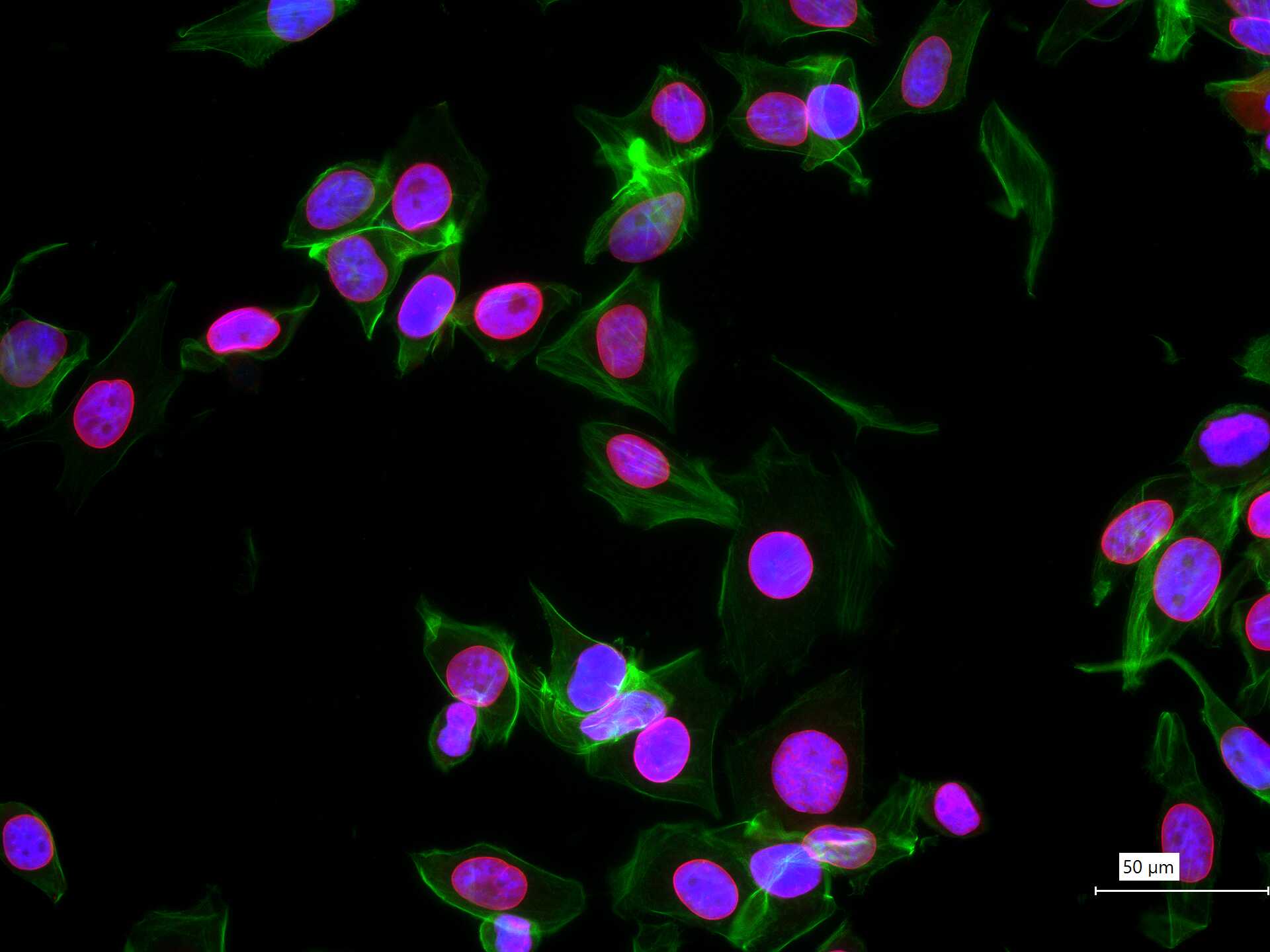 核纤层蛋白A重组兔单抗-bsm-62886R