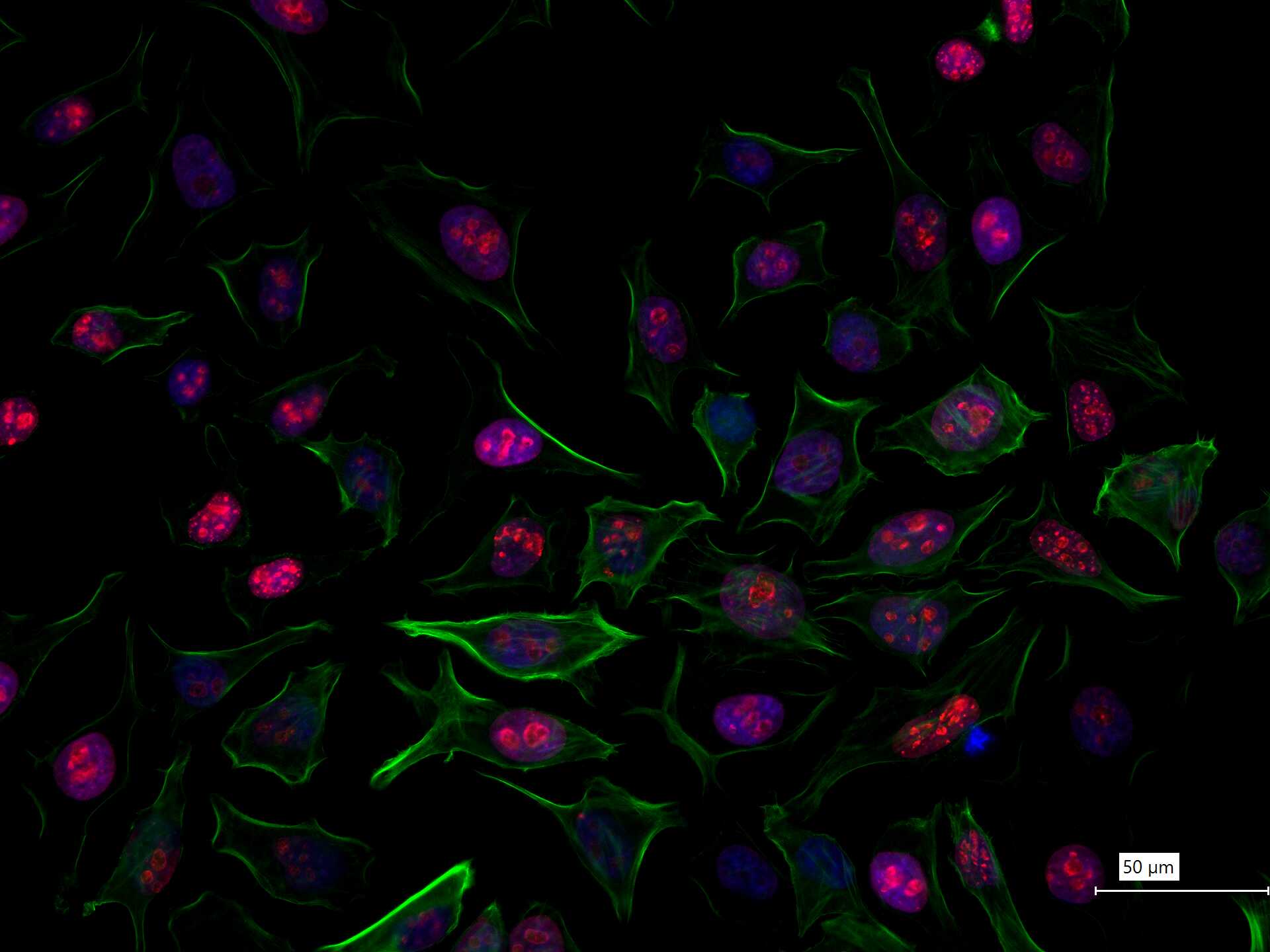 Ki67重组兔单抗-bsm-52455R