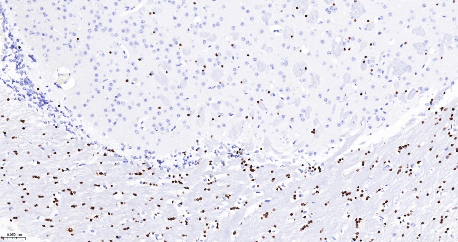 少突胶质细胞转录因子2重组兔单抗-bsm-61115R