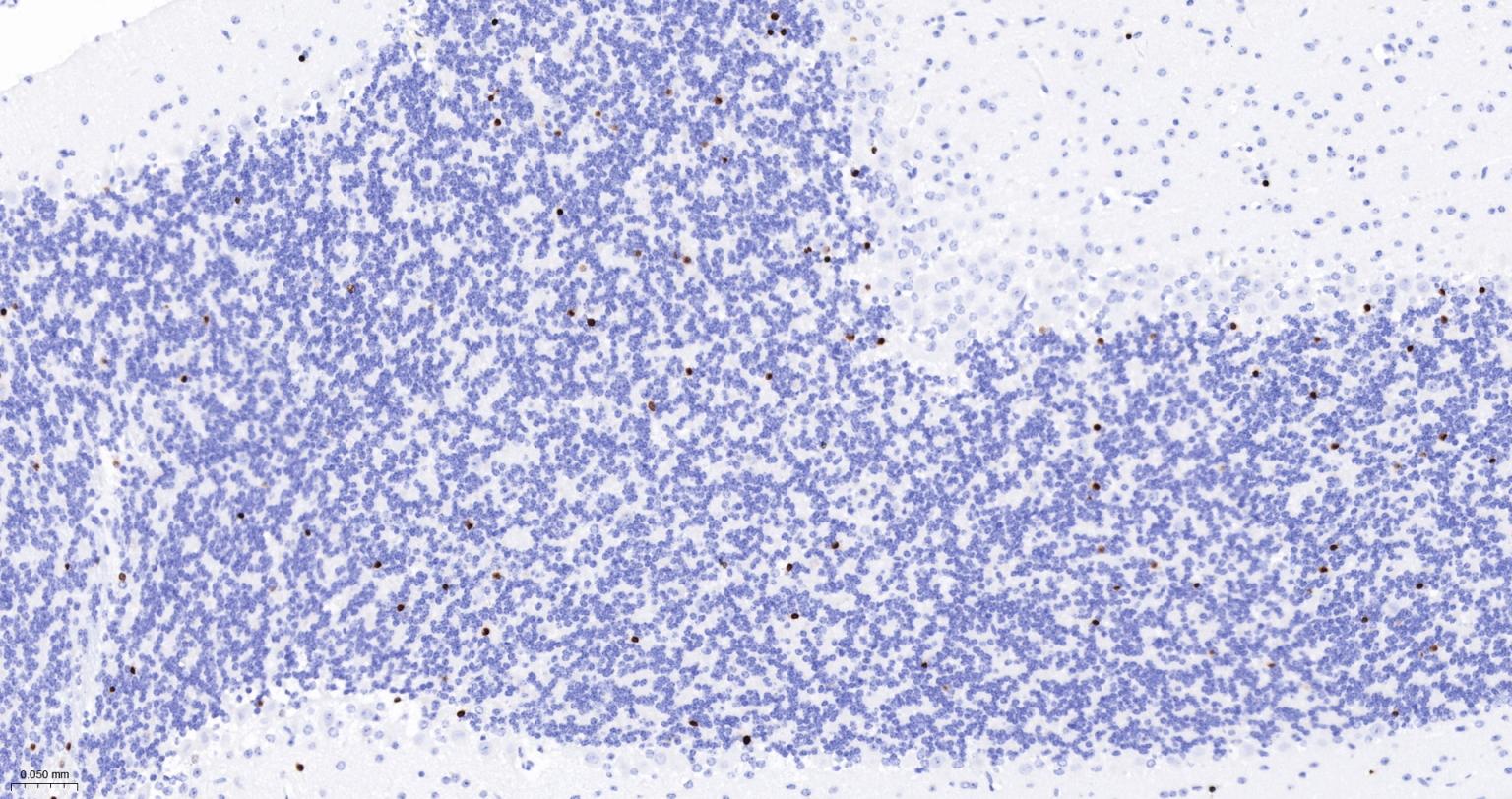 少突胶质细胞转录因子2重组兔单抗-bsm-61115R