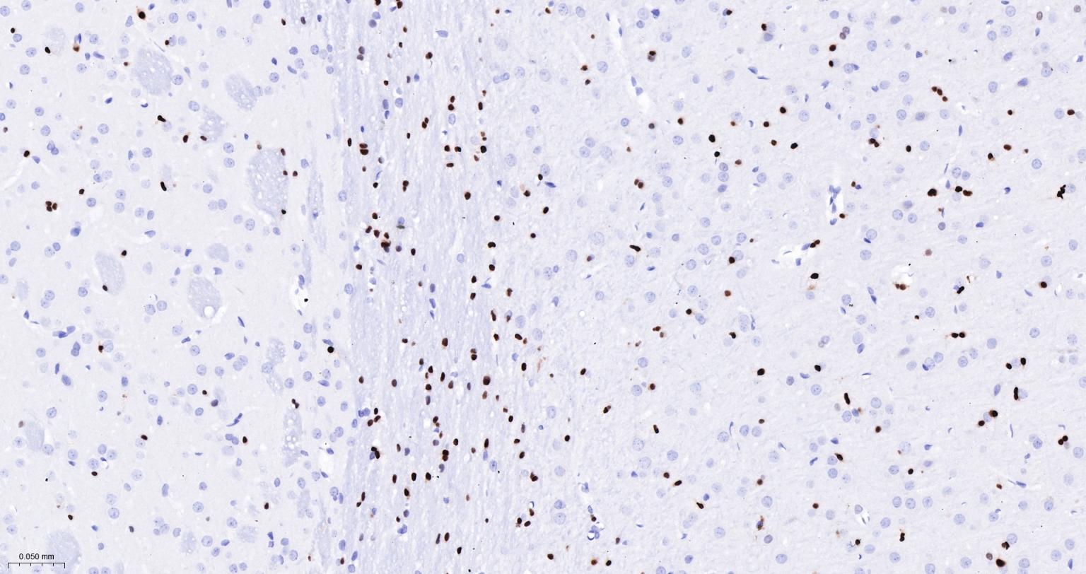 少突胶质细胞转录因子2重组兔单抗-bsm-61115R