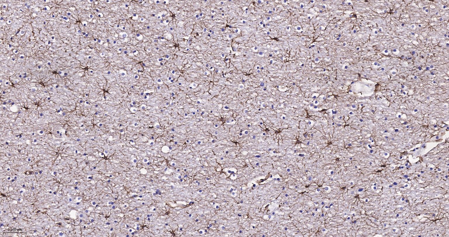 胶质纤维酸性蛋白单克隆抗体-bsm-42001M