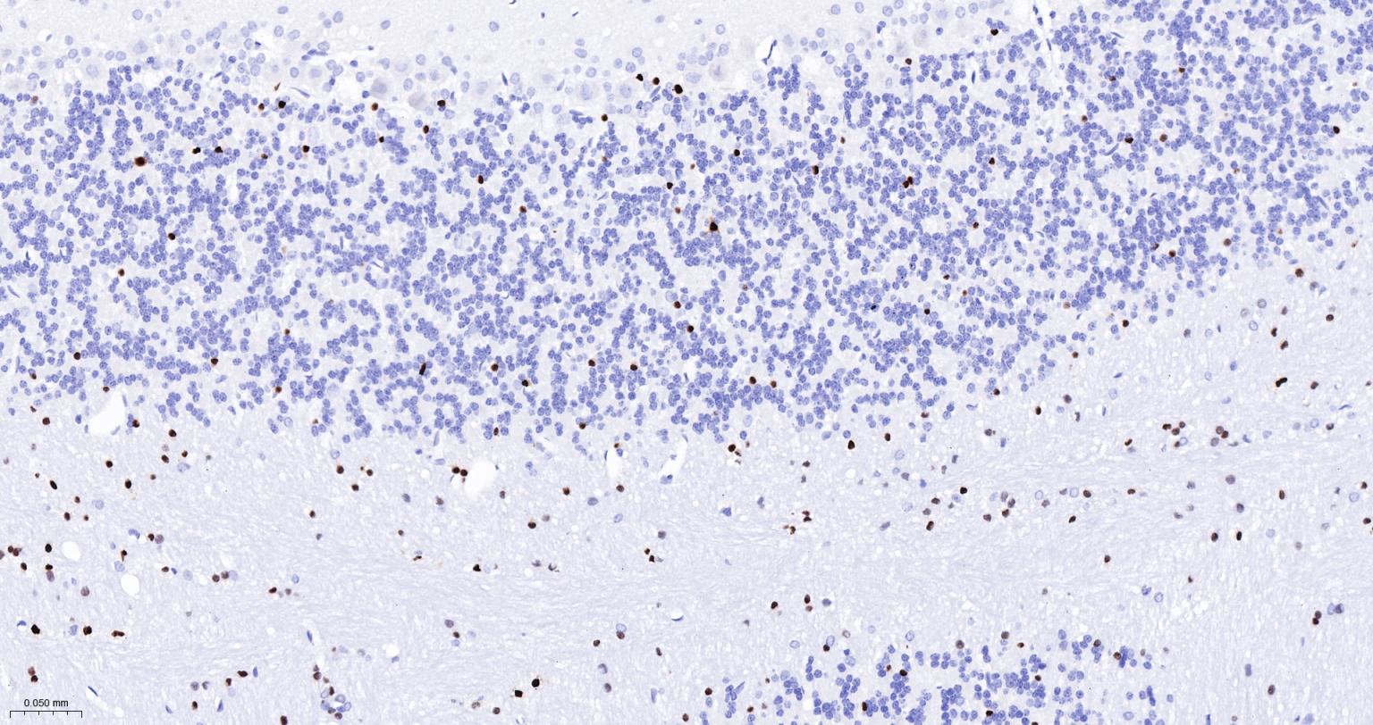 少突胶质细胞转录因子2重组兔单抗-bsm-61115R