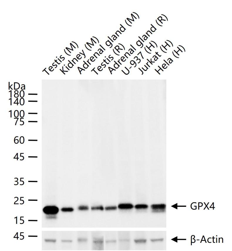 GPX4 Recombinant Rabbit mAb (一抗) - WB,IHC-P,IHC-F,IF,ICC/IF | Bioss