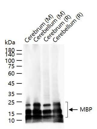 MBP Recombinant Rabbit mAb (一抗) - WB,IHC-P,IHC-F,IF | Bioss