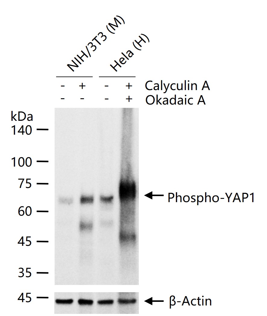 phospho-YAP1 (Ser127) Recombinant Rabbit mAb (一抗) - WB,IHC-P,IHC-F,IF | Bioss