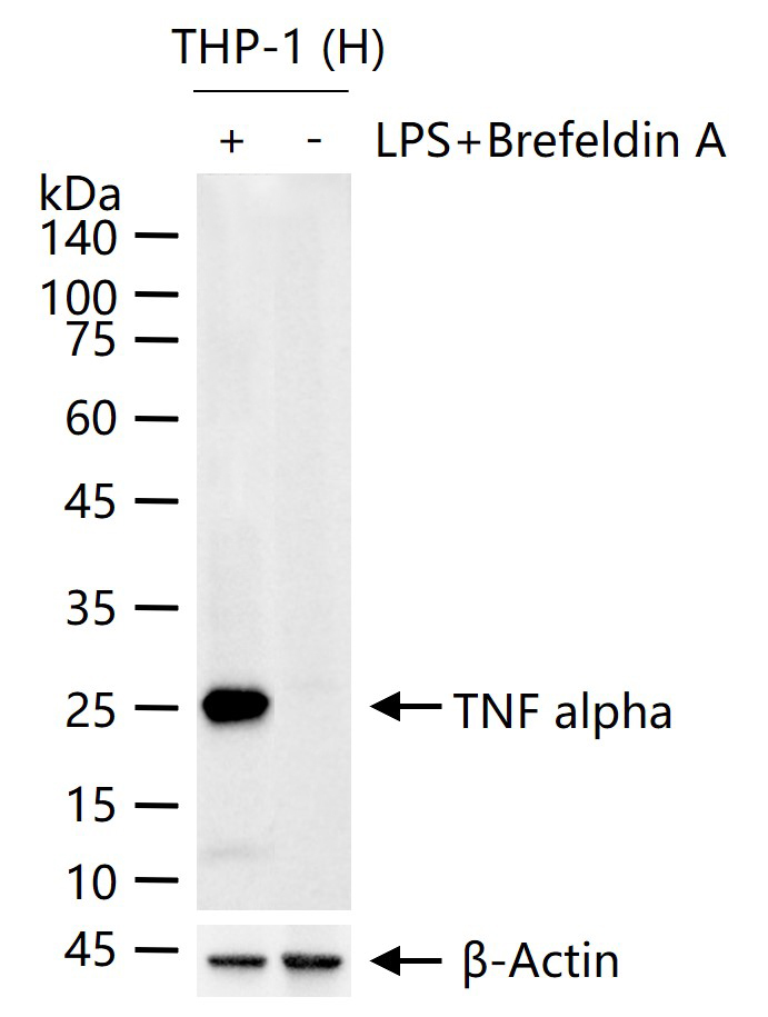 TNF-alpha Recombinant Rabbit mAb (一抗) - WB,IHC-P,IHC-F,IF,IP | Bioss