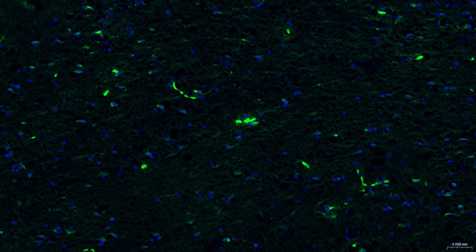 P-糖蛋白重组兔单克隆抗体-bsm-54782R