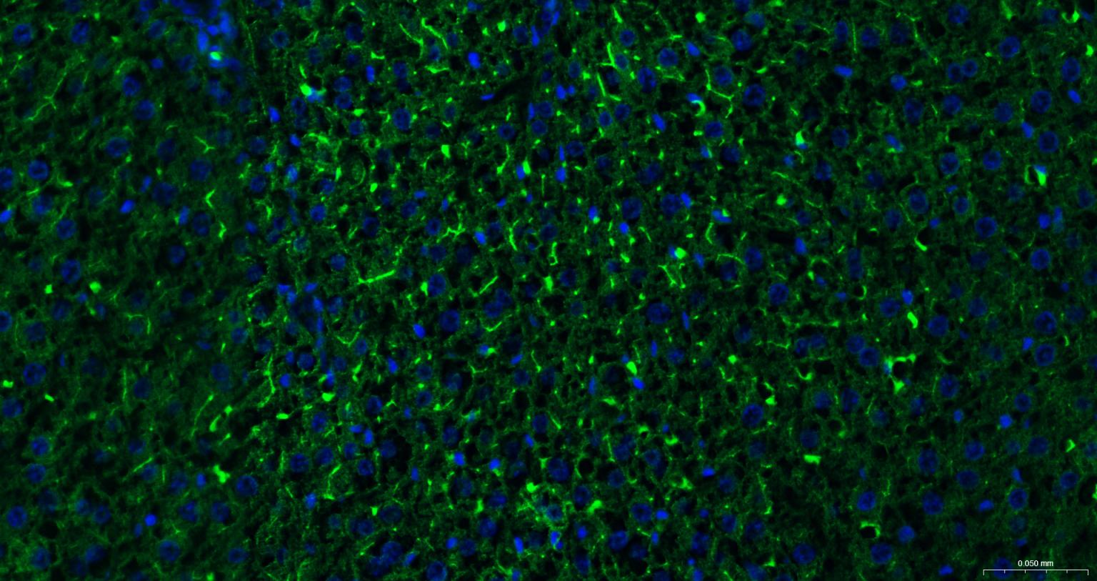 P-糖蛋白重组兔单克隆抗体-bsm-54782R