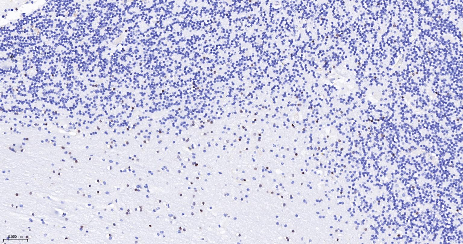 少突胶质细胞转录因子2重组兔单抗-bsm-61115R