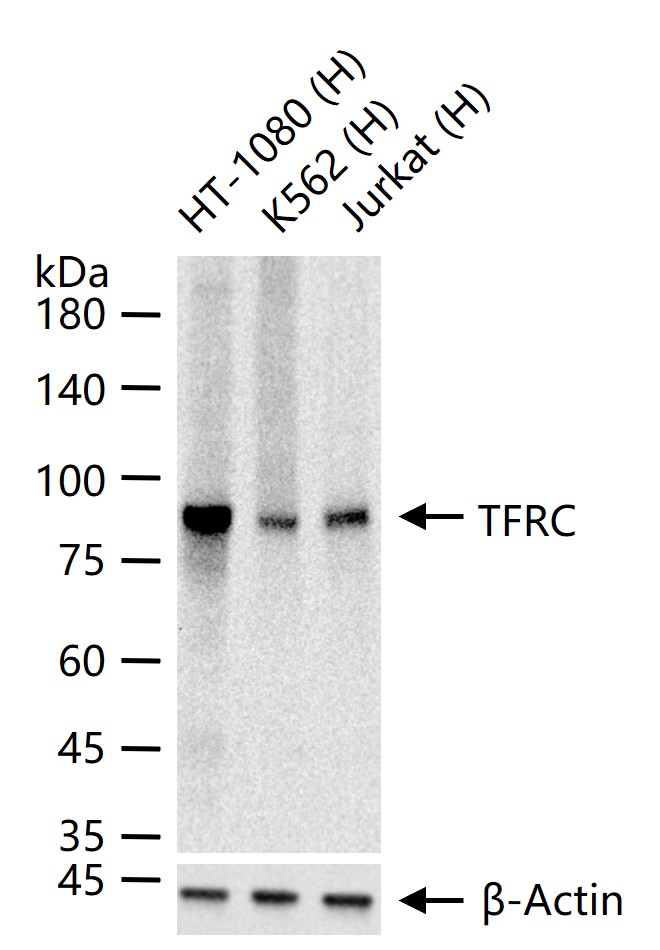 TFRC Rabbit pAb (一抗) - WB,IHC-P,IHC-F,IF,Flow-Cyt | Bioss