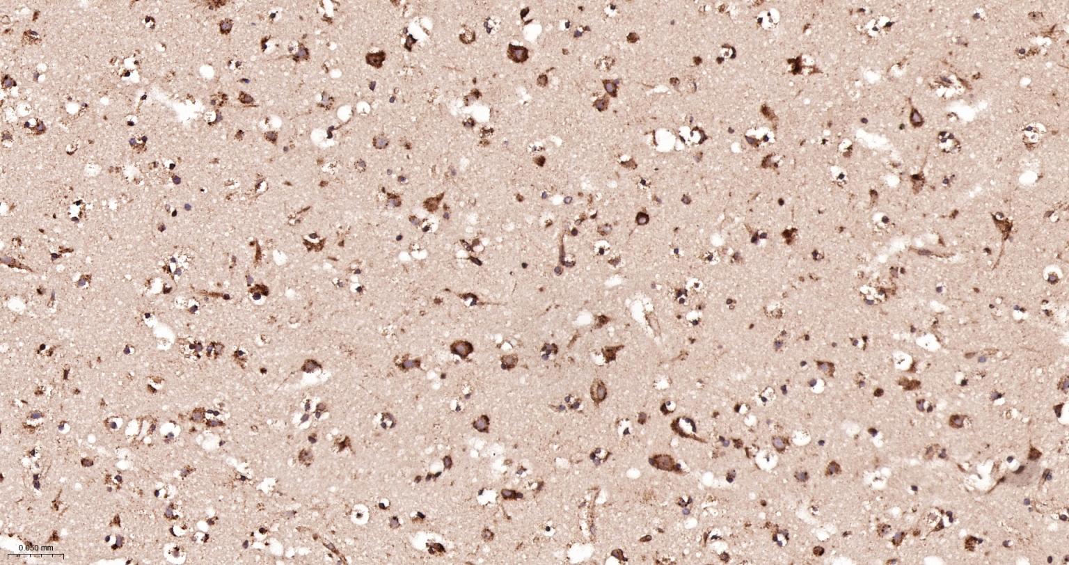 蛋白质二硫键异构酶重组兔单抗-bsm-62363R