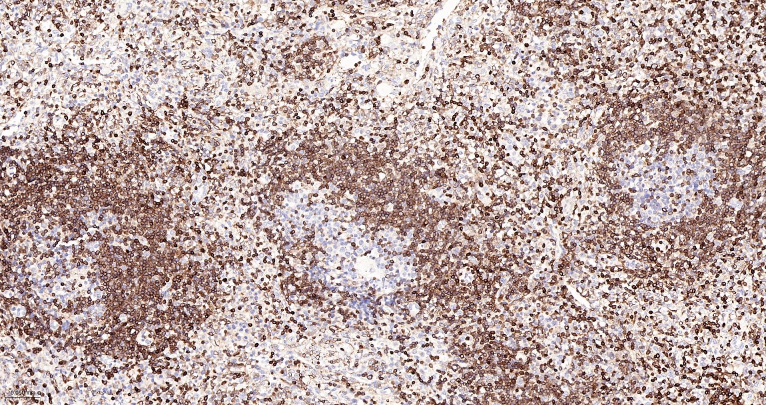 Bcl-2重组兔单抗-bsm-61074R