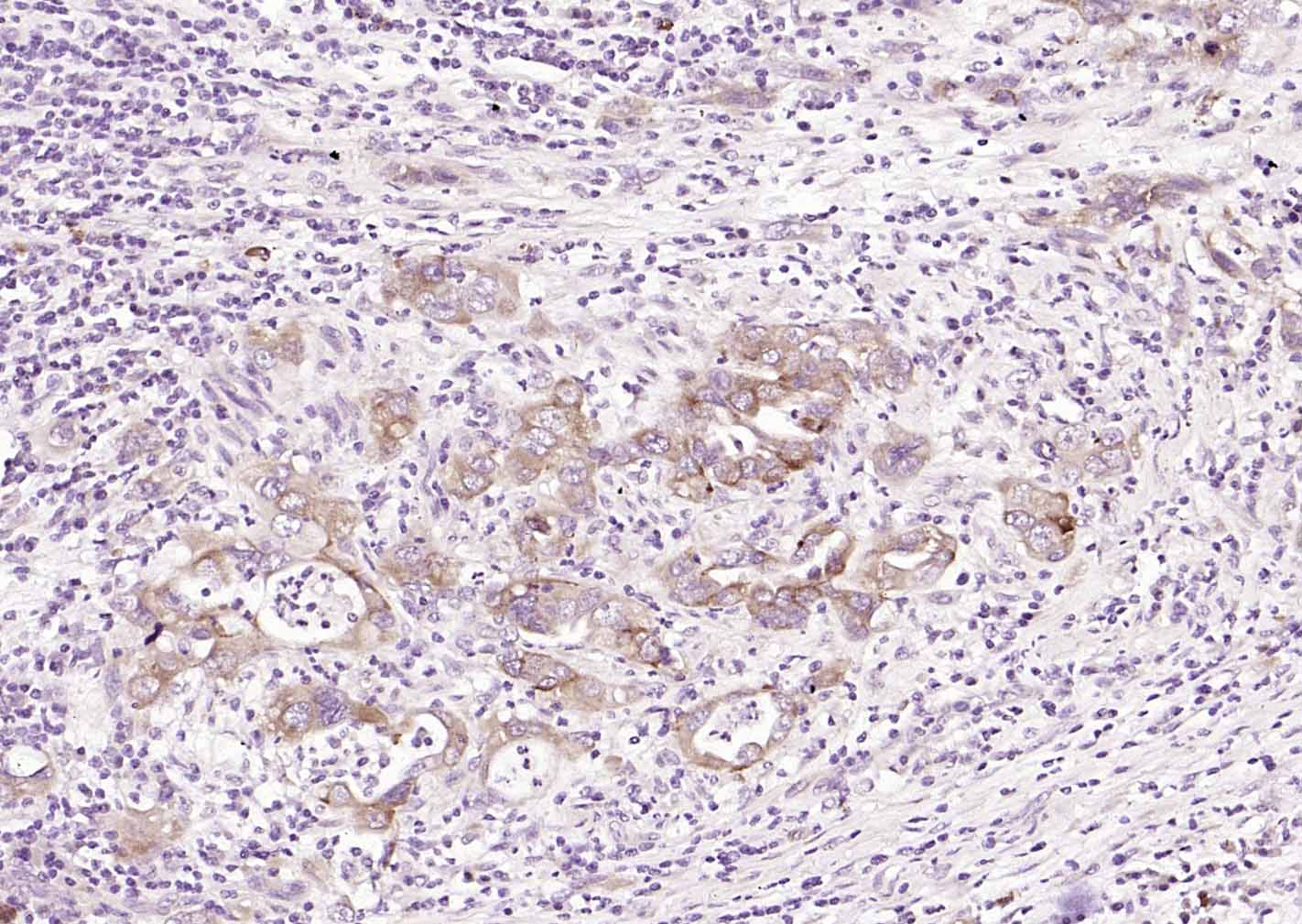 转铁蛋白受体（CD71）抗体-bs-0988R