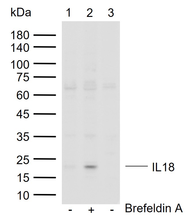 IL18 Rabbit pAb (一抗) - WB | Bioss