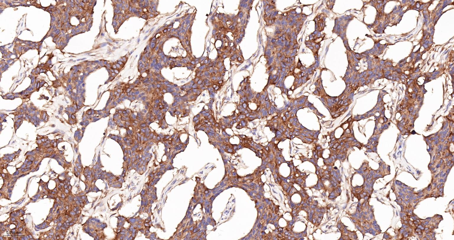 蛋白质二硫键异构酶重组兔单抗-bsm-62363R