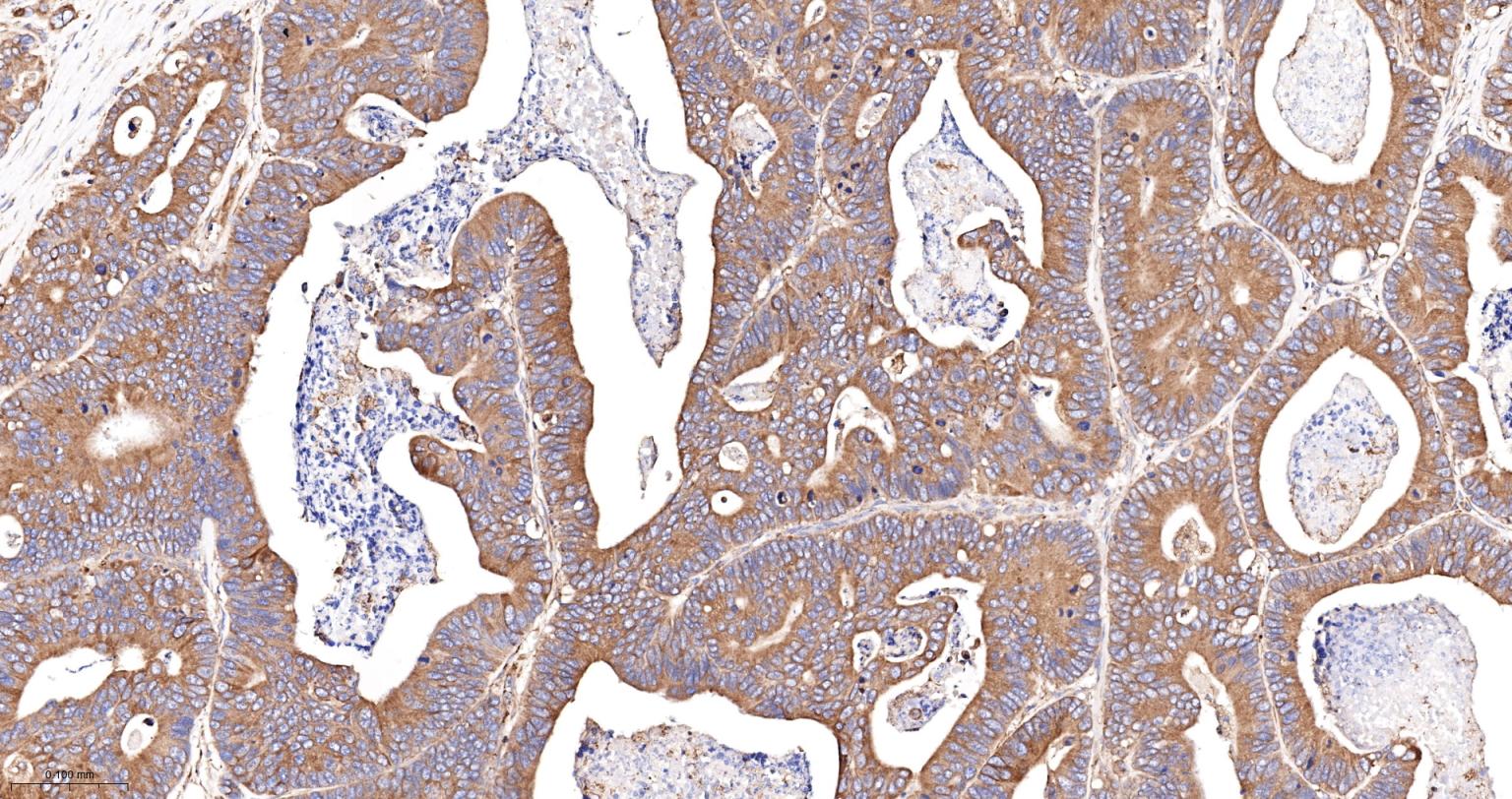 蛋白质二硫键异构酶重组兔单抗-bsm-62363R