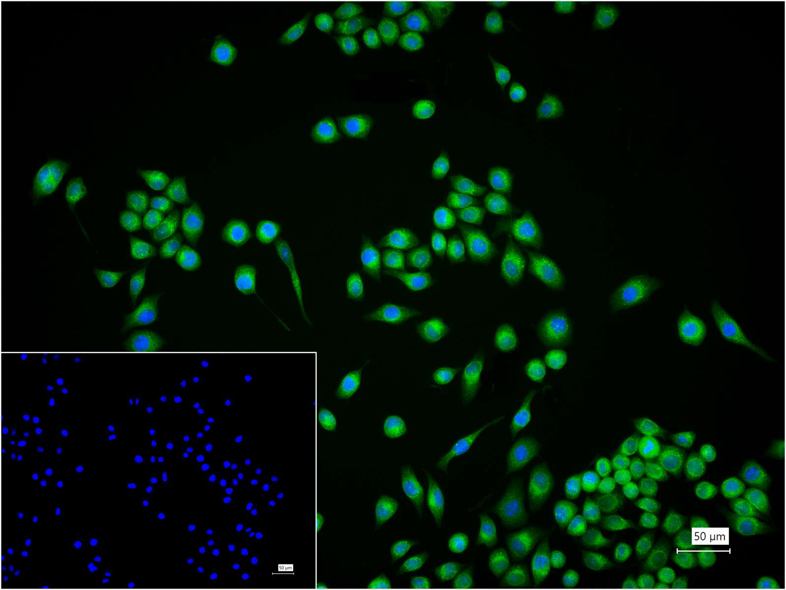 蛋白质二硫键异构酶重组兔单抗-bsm-62363R