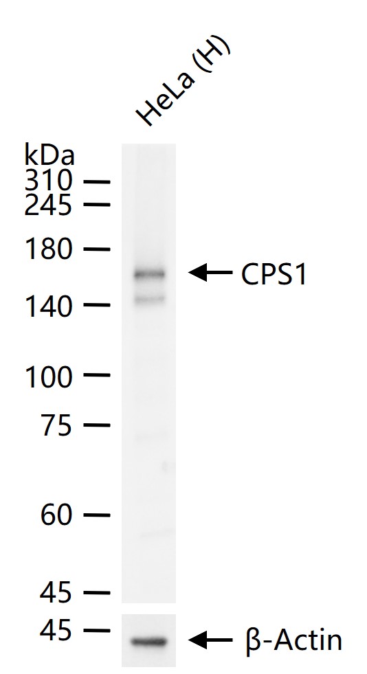 CPS1 Recombinant Rabbit mAb (一抗) - WB,IHC-P,IHC-F,IF | Bioss