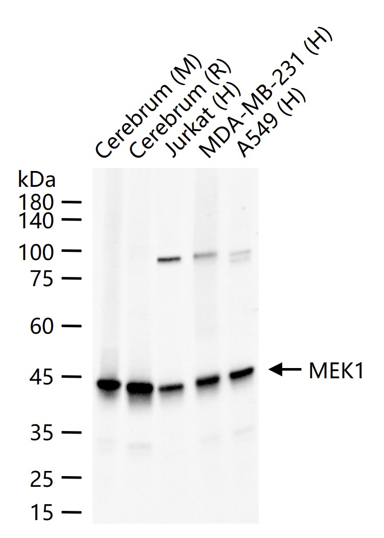 MEK1 Recombinant Rabbit mAb (一抗) - WB,IHC-P,IHC-F,IF | Bioss