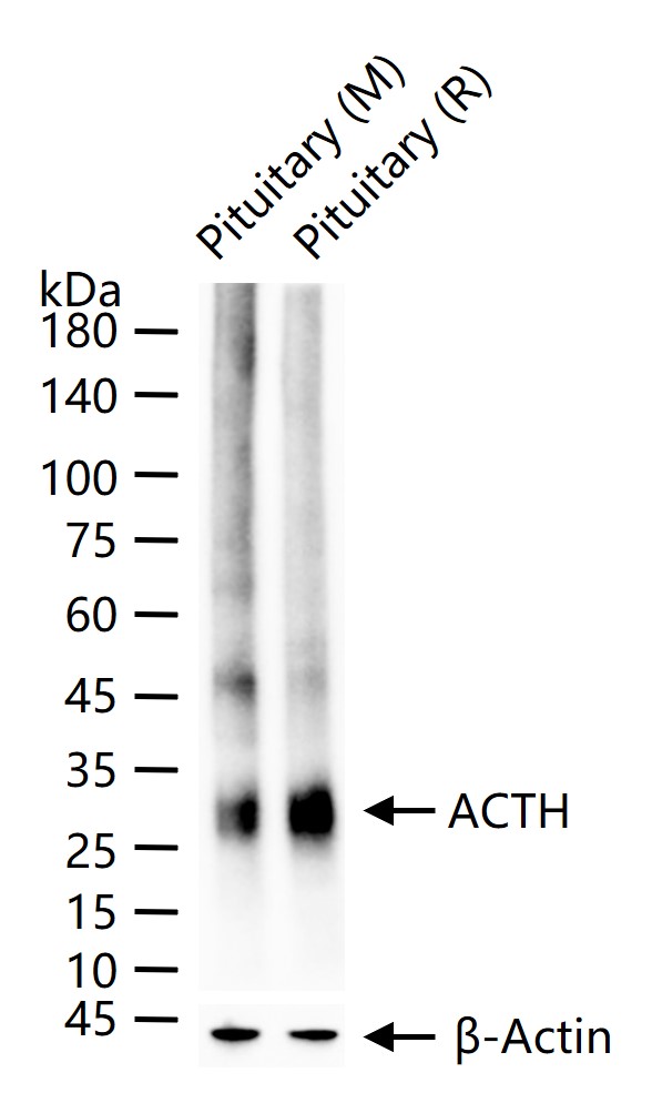 ACTH Recombinant Rabbit mAb (一抗) - WB,IHC-P,IHC-F,IF | Bioss