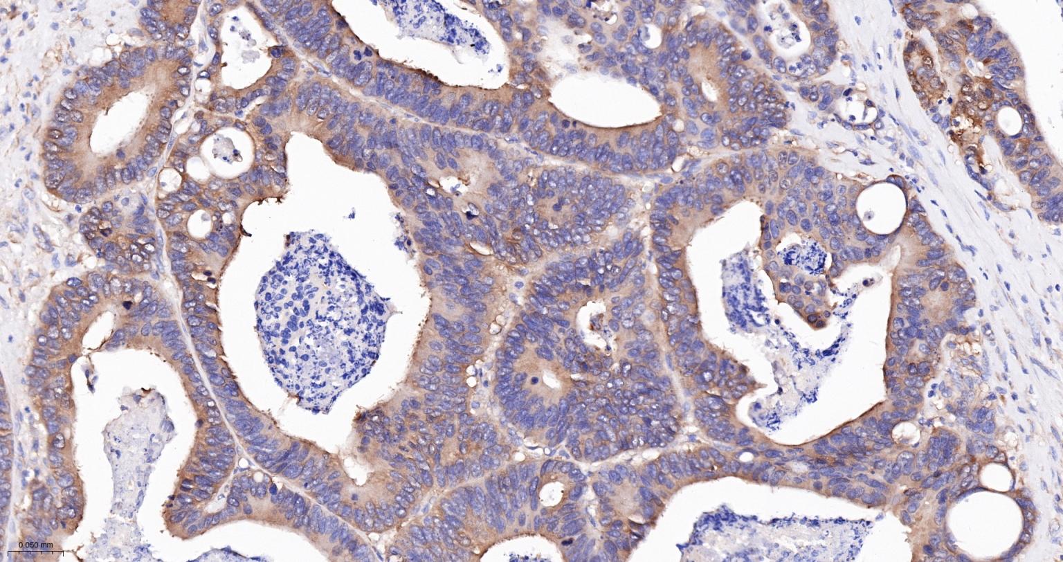 骨形态发生蛋白2重组兔单抗-bsm-61413R