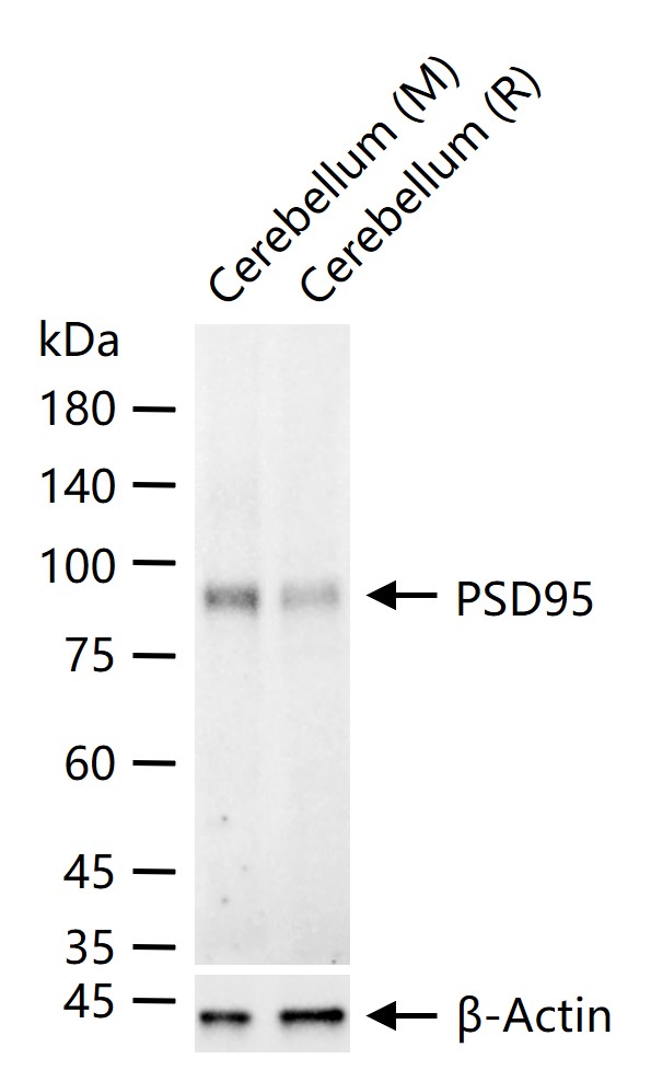 PSD95 Rabbit pAb (一抗) - WB | Bioss