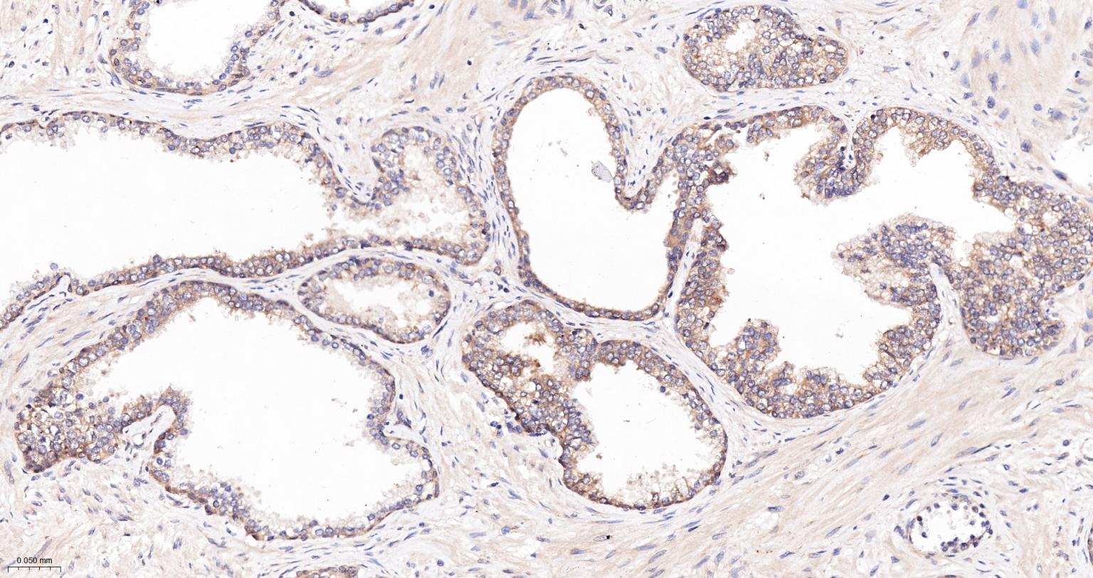 骨形态发生蛋白2重组兔单抗-bsm-61413R