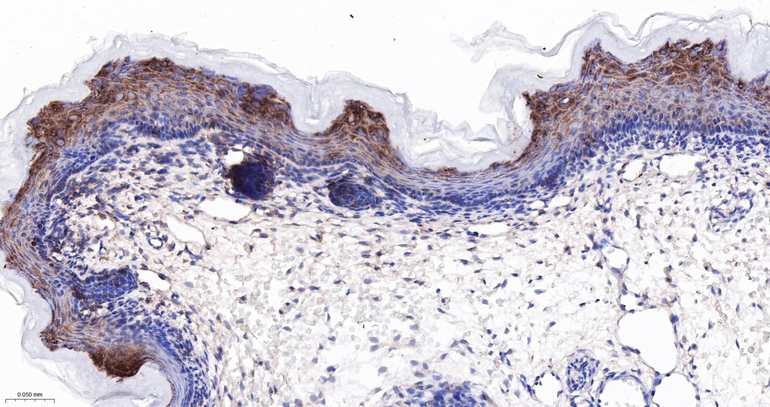 骨形态发生蛋白2重组兔单抗-bsm-61413R