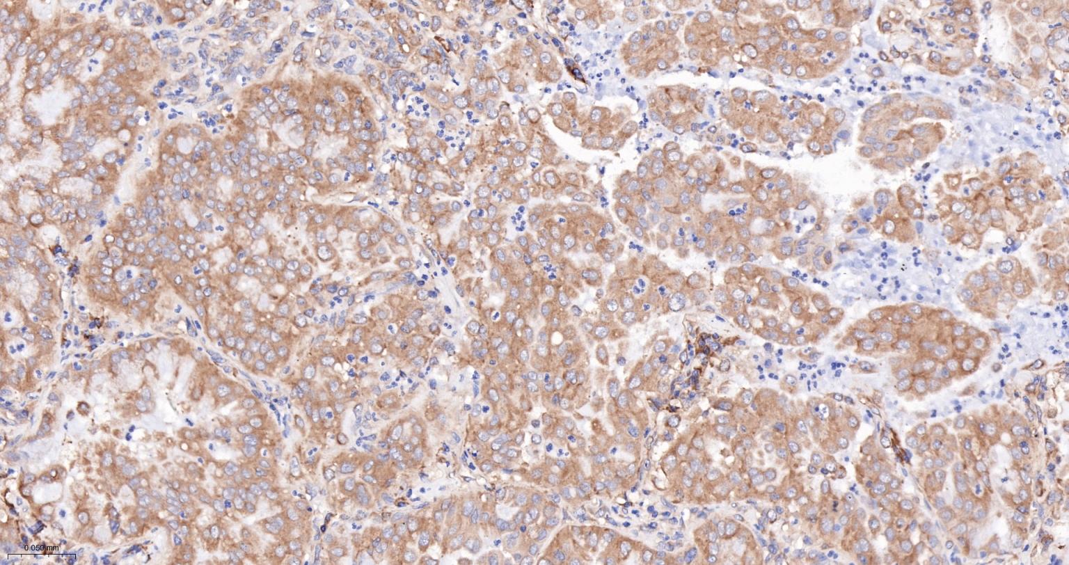 骨形态发生蛋白2重组兔单抗-bsm-61413R