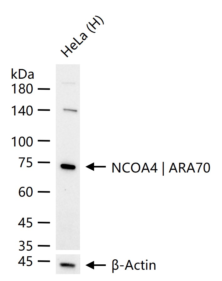 NCOA4 | ARA70 Recombinant Rabbit mAb (一抗) - WB | Bioss