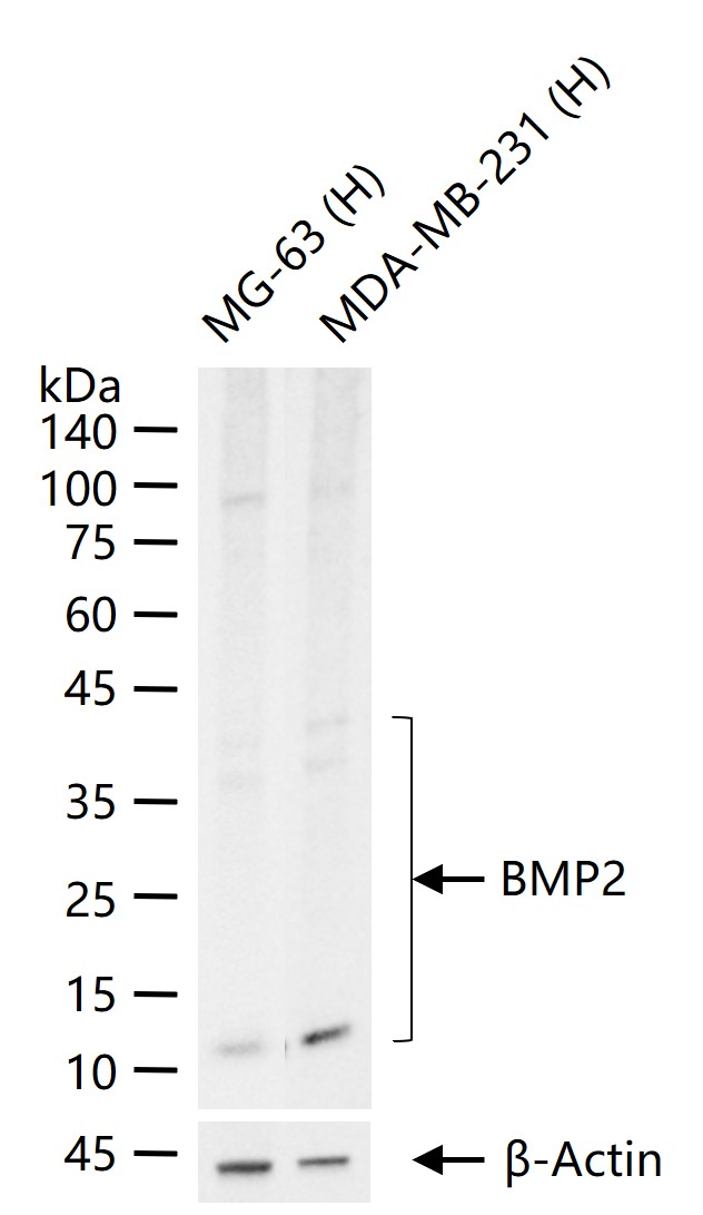 BMP2 Recombinant Rabbit mAb (一抗) - WB,IHC-P,IHC-F,IF | Bioss