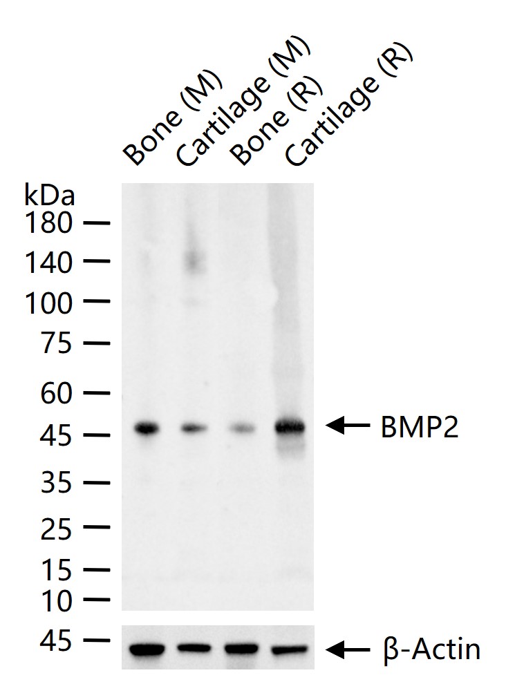 BMP2 Rabbit pAb (一抗) - WB | Bioss