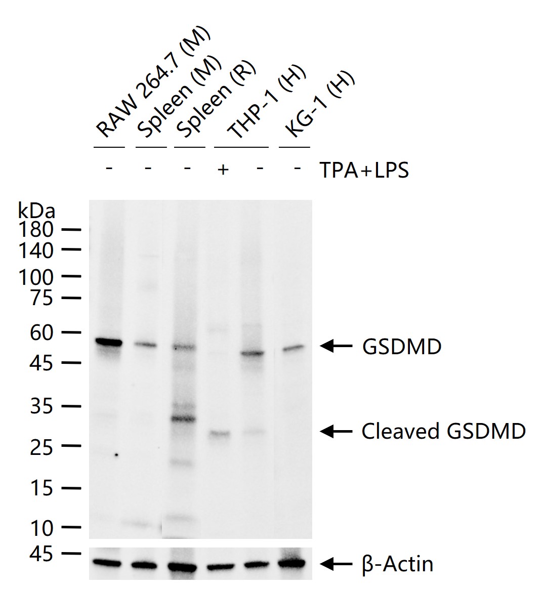 GSDMD Recombinant Rabbit mAb (一抗) - WB,IHC-P,IHC-F,IF | Bioss