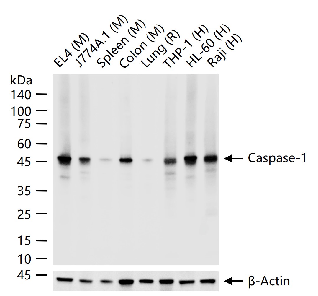 Caspase-1 Recombinant Rabbit mAb (一抗) - WB,IHC-P,IHC-F,IF | Bioss